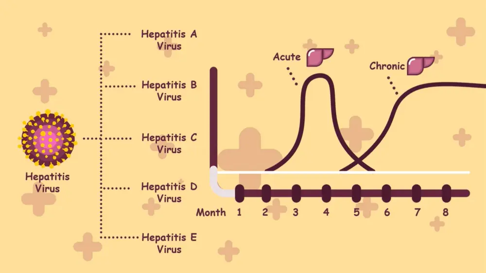 What Are the Symptoms of Viral Hepatitis