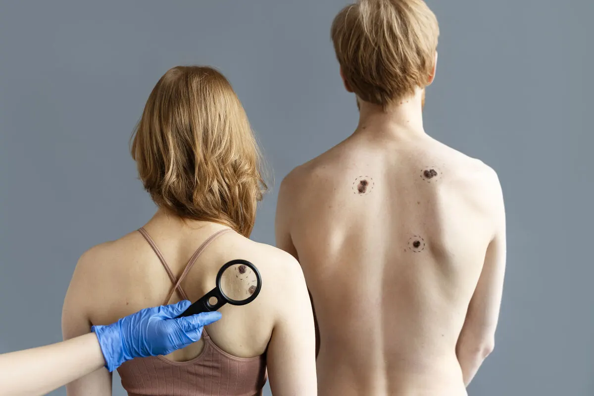 Your Skin’s Guardian: Care Dermatology and Skin Cancer Centers