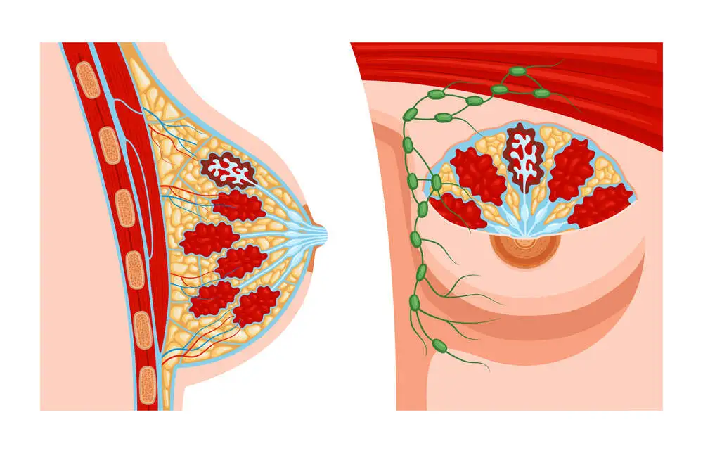 Can You Breastfeed with Breast Implants